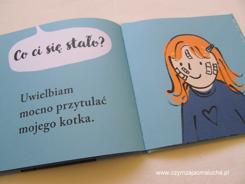 co-sie-stalo-male-wypadki-5